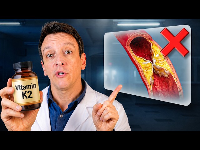 New Evidence On Vitamin K2 and Clogged Arteries Changes Perspective