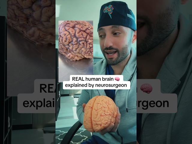 This is what the surface of your brain looks like. #medical #doctor #anatomy #brain #neurosurgery