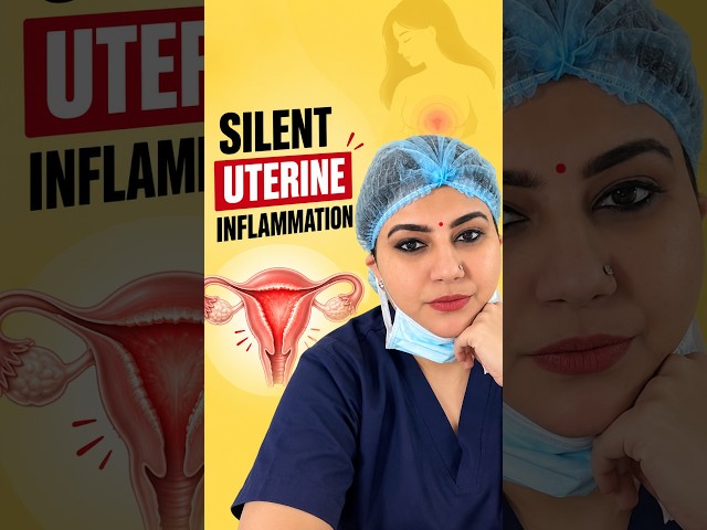 Chronic Endometritis: The Silent Uterine Inflammation Affecting IVF Success