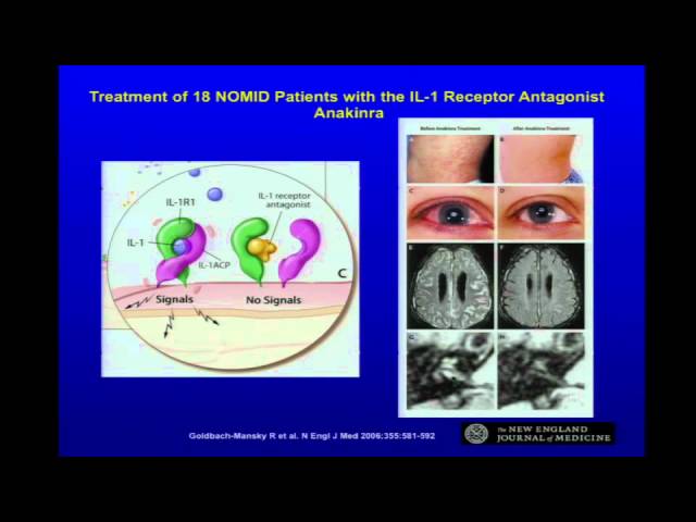 Adventures in the Genomics of Inflammation - Daniel Kastner