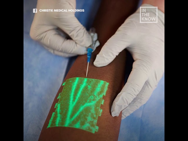 New medical technology helps nurses insert an IV on the first try