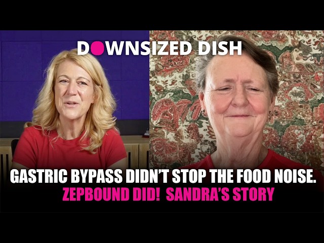 Gastric Bypass Didn’t Stop the Food Noise. Zepbound Did! Sanda's Story