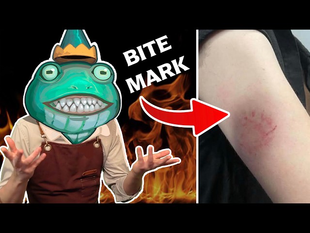 Attacked by AI Vendor After Call Out
