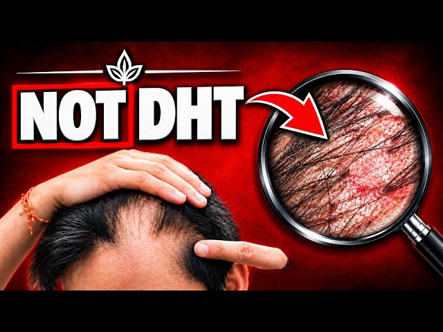 7 Signs Your Hair Loss Is Scalp Inflammation (Not DHT)