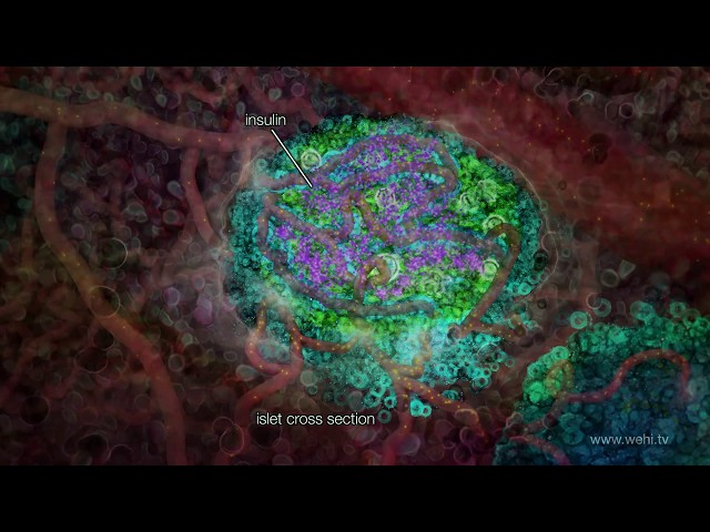 Inflammation and Type 2 Diabetes (2014) By Maja Divjak wehi.tv