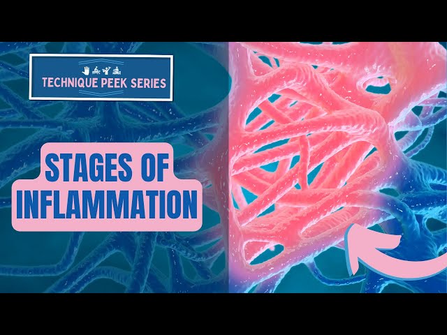 Stages of Inflammation |  Technique Peek Series