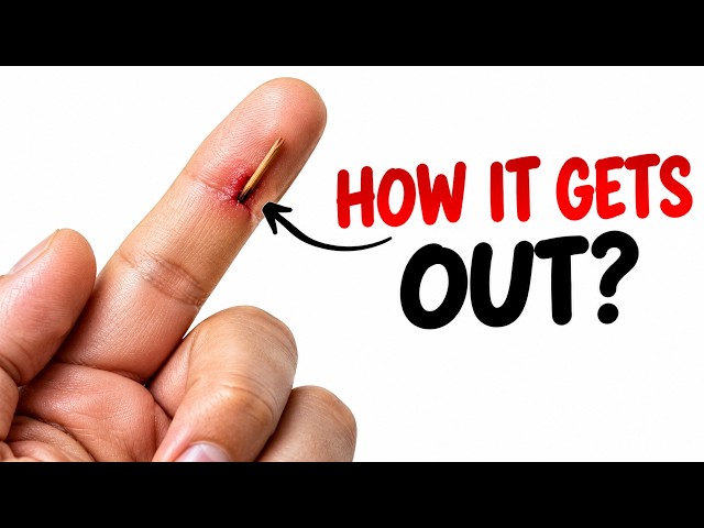 How Splinters Get Unstuck 😲 | What Happens Under Your Skin?