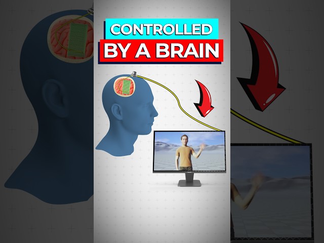 Scientists Create Brain Implant To Restore Speech and Movement