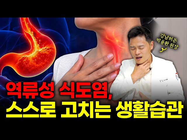 How to Manage Acid Reflux at Home Without Going to the Hospital