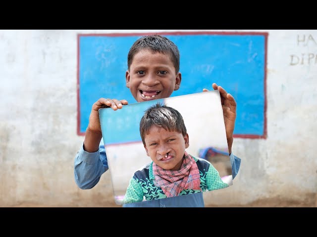 The Story of Vikas | 360° Smiles