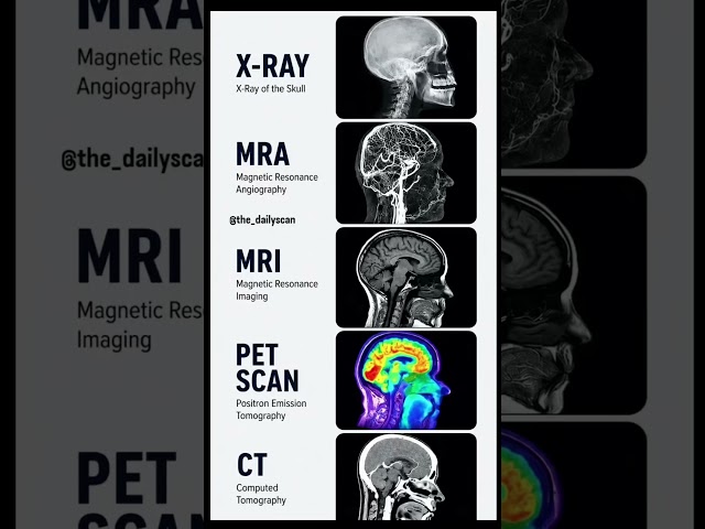 Doctor Explains Every Type of Brain Scan...