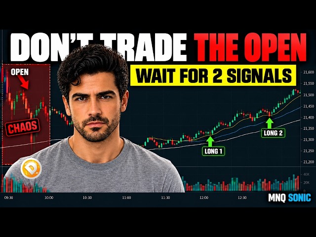 The Market Open Is a Trap — Here’s What I Wait For Instead