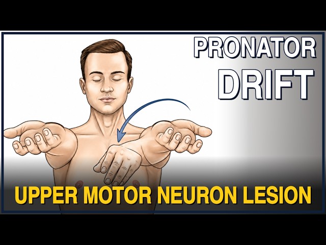 Pronator Drift | Upper Motor Neuron Lesion