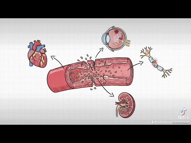 #Diabetes & Insulin Resistance Explained | Type 1 vs Type 2 Diabetes