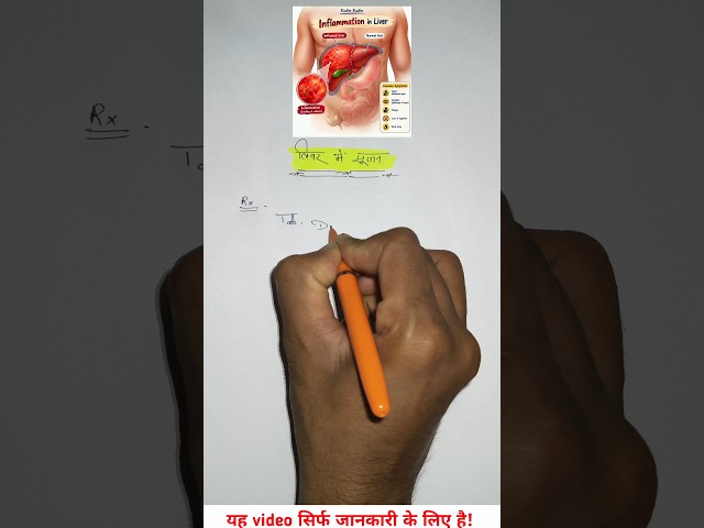 liver me swelling in hindi treatment #mednotes #ytshorts #explorepage