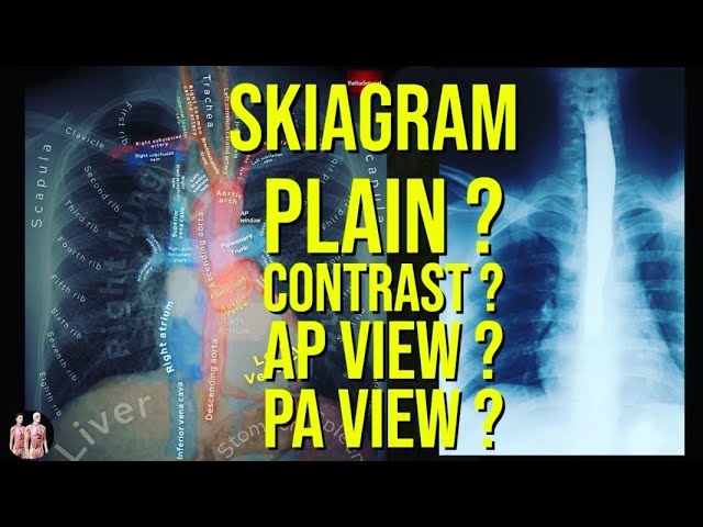 Thorax Radiological Anatomy | Plain, Contrast Skiagrams | Chest X-Ray | Anatomy Decoded