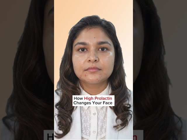 Hormonal changes can affect the way your face looks 😳 | Dermatologist Explains