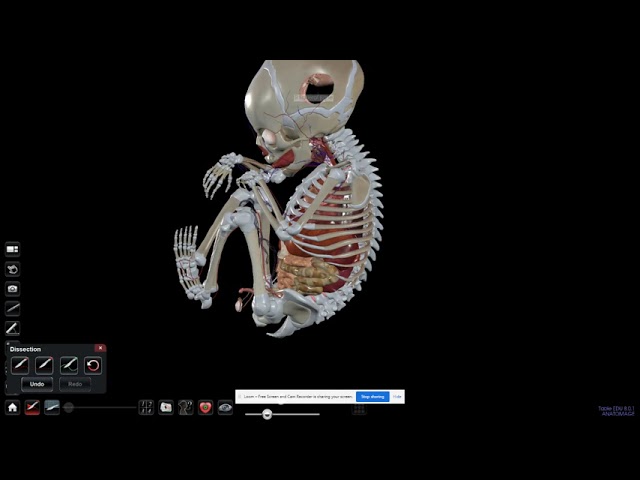 Anatomage: High Resolution Fetus- Version 8
