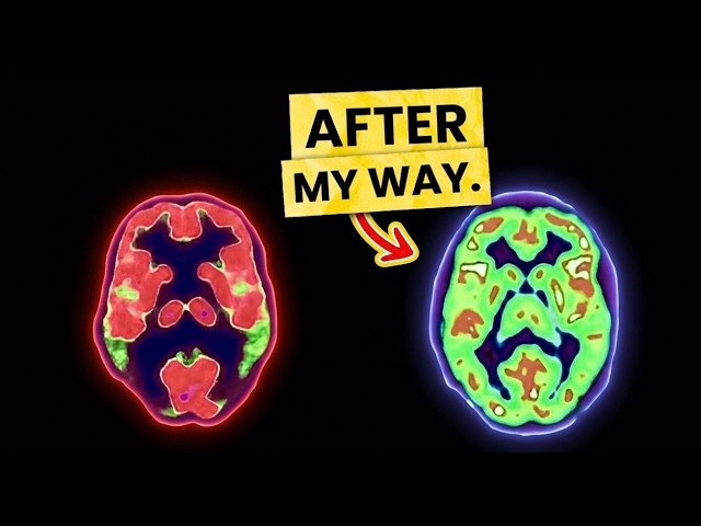 Why You Can Focus for Hours on Fun, But Not Work: ADHD Science