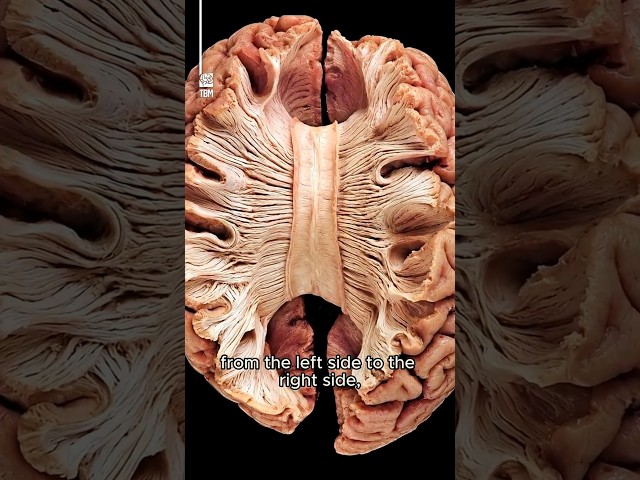 You Have A Bridge In Your Brain