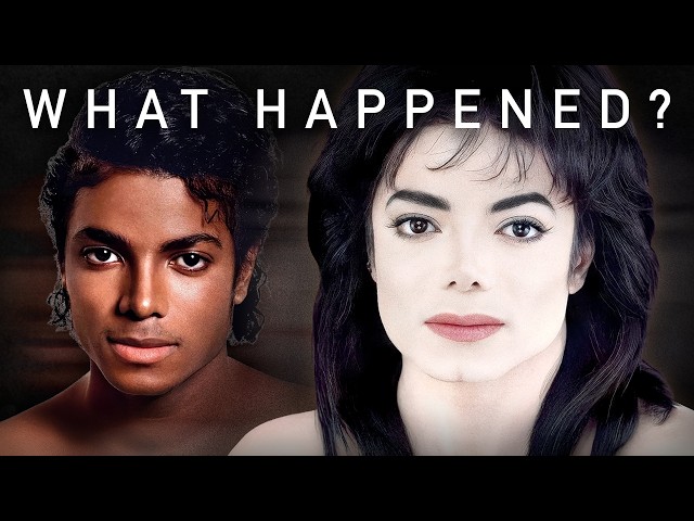 Michael Jackson’s Skin: The Truth About Vitiligo, Depigmentation and Bleaching | the detail.