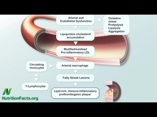 The Leaky Gut Theory of Why Animal Products Cause Inflammation