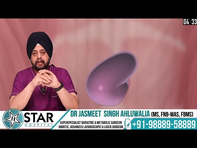 What is Umbilical Hernia in Hindi | Umbilical Hernia - Causes, Recovery, Symptoms & Treatment
