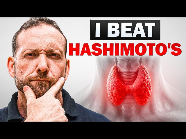 How I Put My Hashimoto’s Into Remission