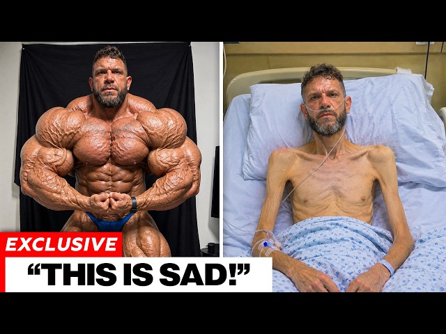 10 Bodybuilders Who Became Unrecognizable After Quitting