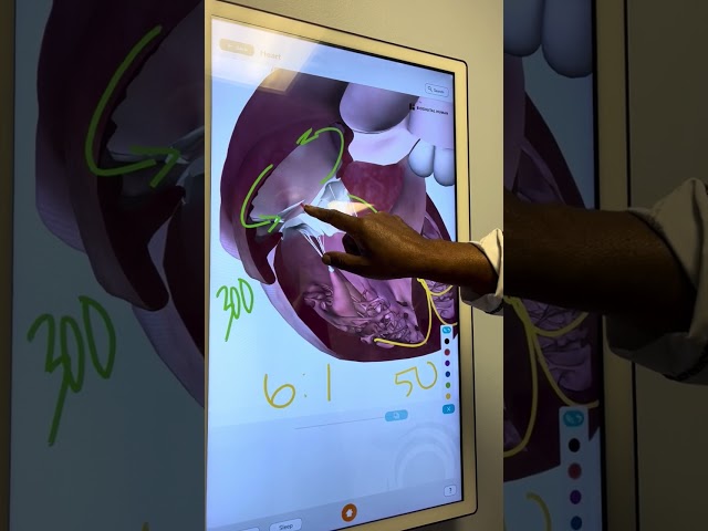 Cardiology A-Flutter 3D