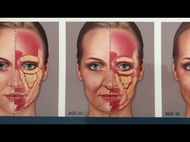 Facial Aging Process
