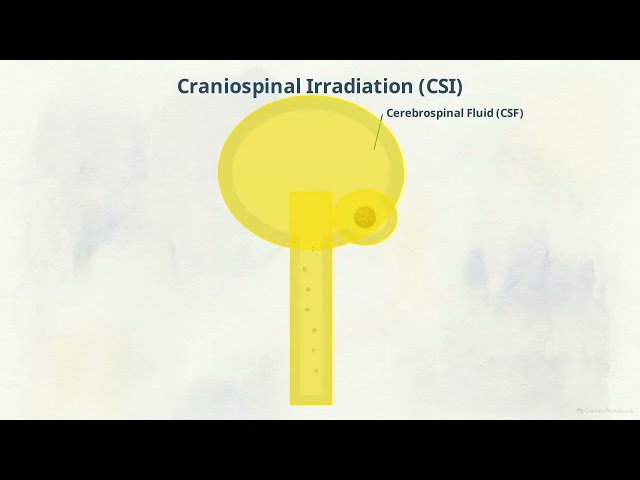 13 2 Radiotherapy