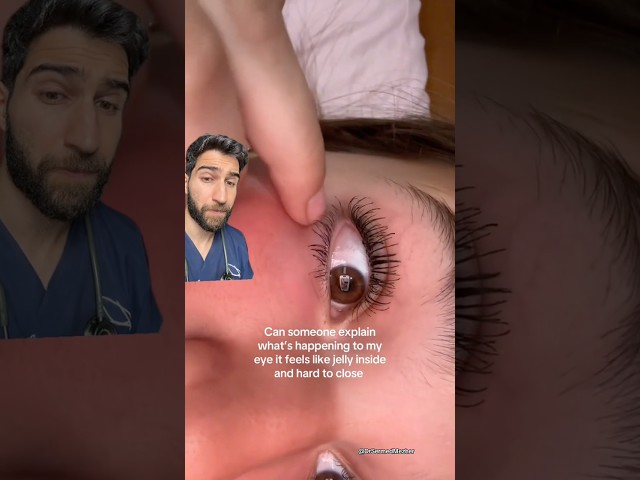 “Your Immune System Has Found Your Eyes” #wait
