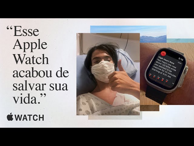 Querida Apple | Apple Watch