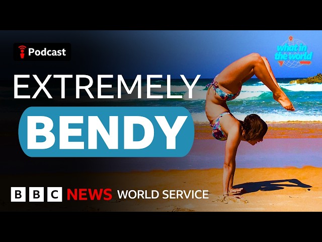 What's it like to live with hypermobility? - What in the World podcast, BBC World Service