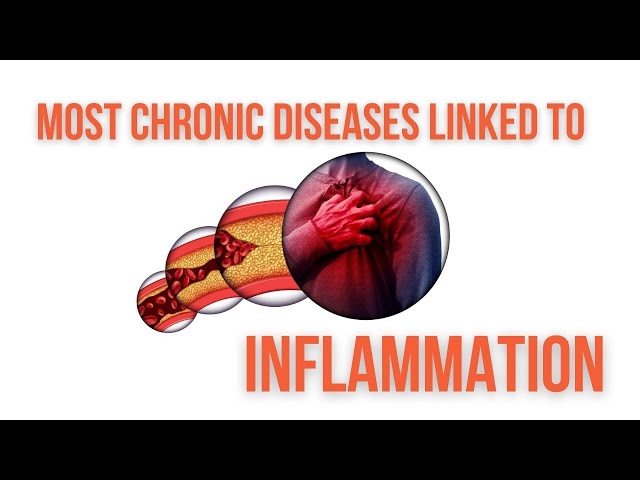 Most chronic diseases linked to inflammation