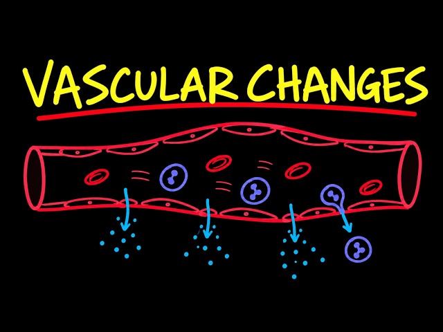 Vascular changes in acute inflammation - Robbins Pathology