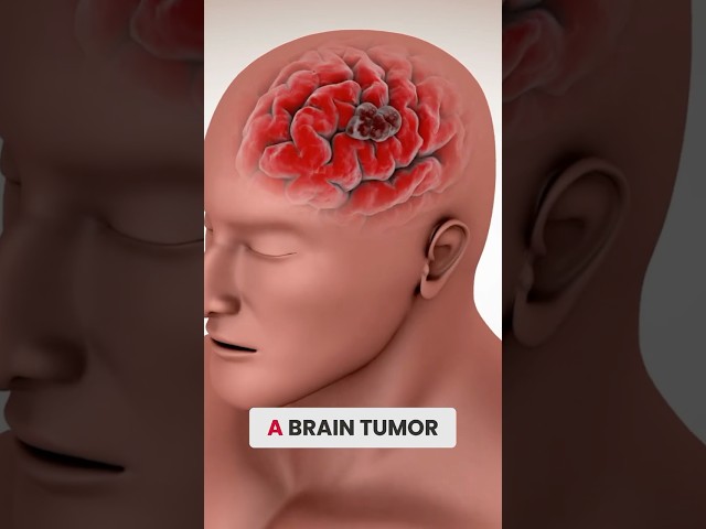 Focused Ultrasound Enhances Brain Tumor Treatment