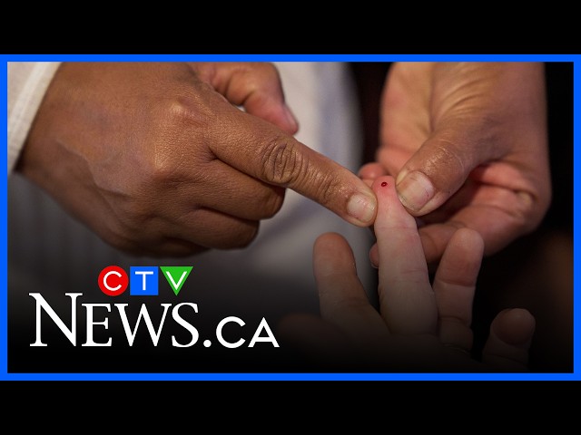 Breaking down misconceptions about Type 2 diabetes