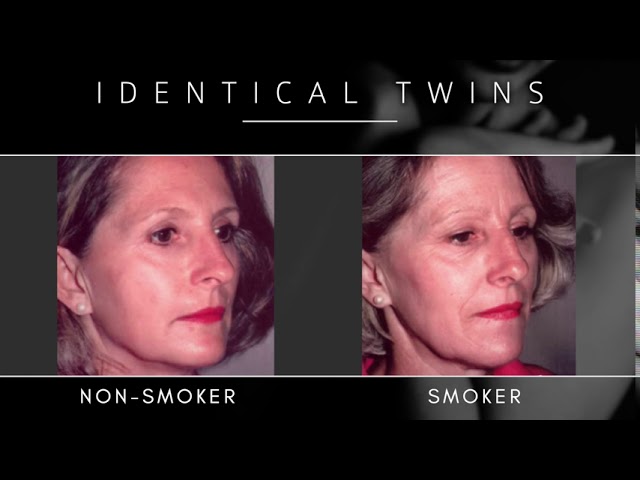 The Aging Process | Dr. Darrick Antell