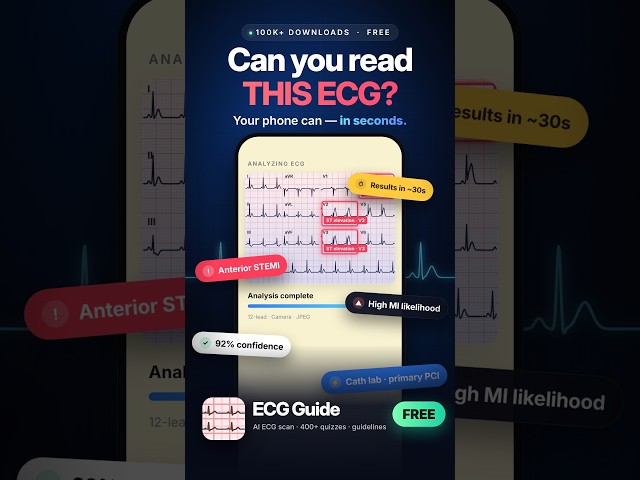 ECG interpretation just got faster, smarter, and more interactive.