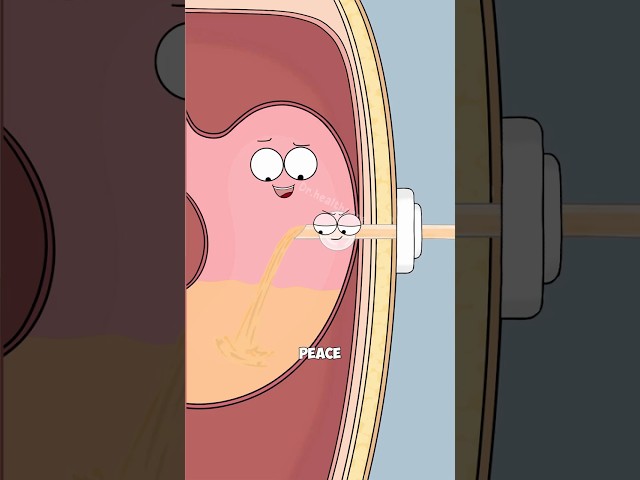 This Tube Delivers Food Straight Into The Stomach
