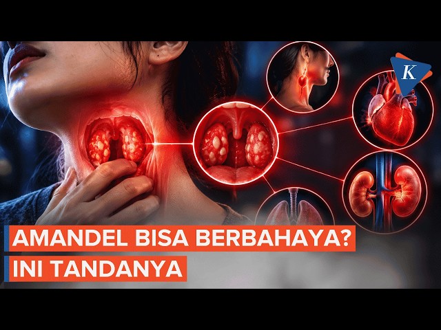 Recurring Tonsillitis Can Lead to Complications, When Should You See a Doctor?