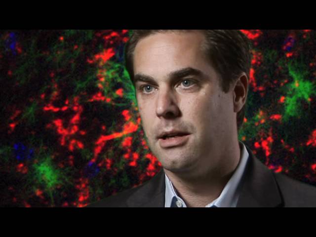 Delaying the aging process protects against Alzheimer's disease