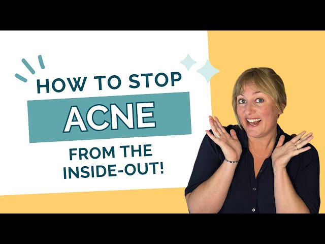 Functional Medicine Acne Strategies