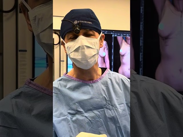 375ccs over the muscle breast augmentation | Six Surgery | Toronto