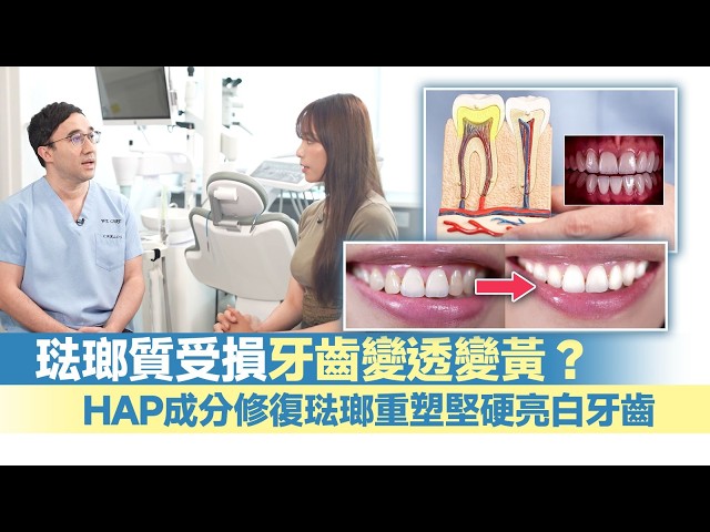 東張西望｜琺瑯質受損牙齒變透變黃？HAP成分修復琺瑯重塑堅硬亮白牙齒