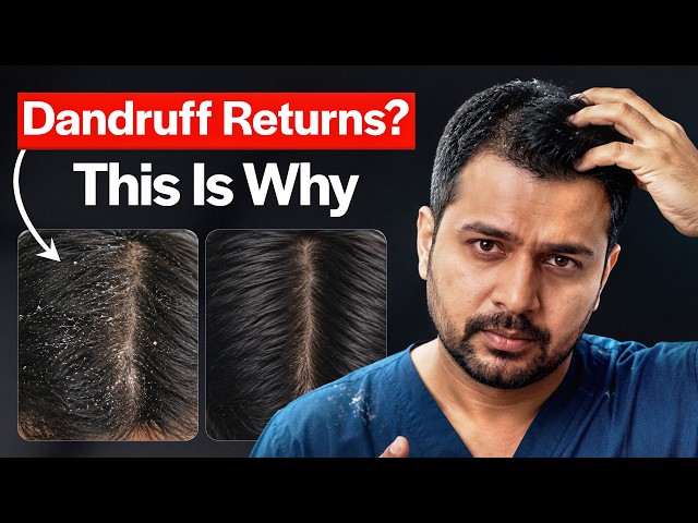 Why Does Your Dandruff Keep Coming Back? (HX-YZSG) | Anti-Dandruff Shampoo Not Working?