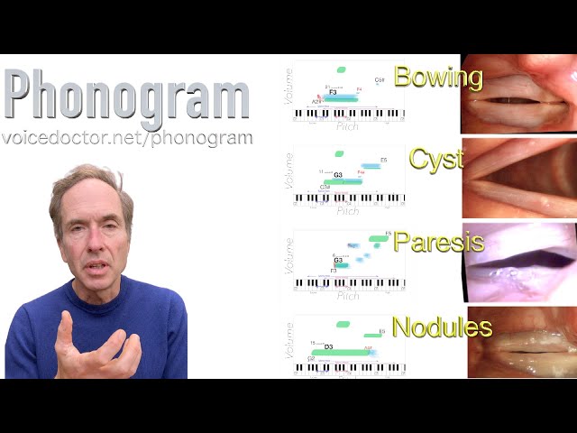 Phonogram - identifying a voice disorder