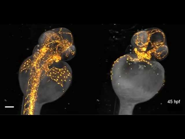 Beautiful imaging of zebrafish development